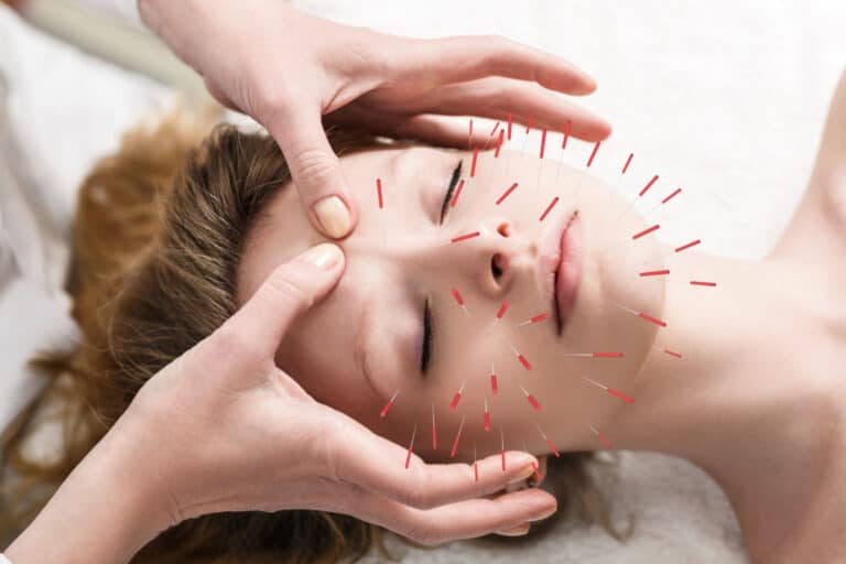 Corpus Aesthetics Health How Acupuncture Helps Athletes' Injuries